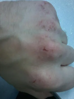 Трещины на пальцах возле ногтей – причины появления, симптомы, виды,  лечение и профилактика