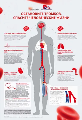 Почему образуются тромбы и как правильно разжижать кровь - ФармМедПром