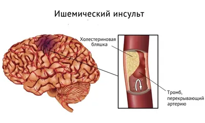 Файл:Рис.13. Сердце.jpg — Википедия