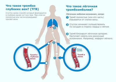 Синие ноги (цианоз) | Флебологический центр Соломахина А.Е