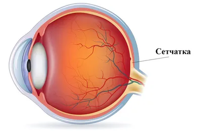 Тромбоз центральной вены сетчатки - лечение глаза, причины