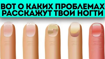 Почему синеют ногти на руках? - HTI CENTERS | Medical Tourism Center