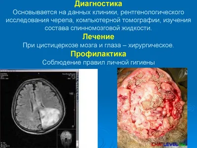 Дерматит Сыпь Вирусное Заболевание С Иммунодефицитом На Теле Молодого  Взрослого Азиата Царапина С Зудом — стоковые фотографии и другие картинки  Обгоревший - iStock