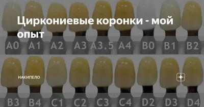 Что нужно знать перед установкой виниров? – «Территория Улыбки»