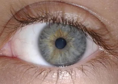 Почему у людей разный цвет глаз: причины | by Wake Up! | Medium