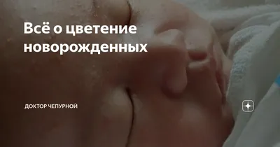 SOS-средства для сухой и чувствительной кожи ребёнка. | Анастасия Ефимова |  Дзен