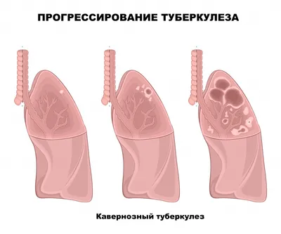 Лучшие мази от розового лишая у человека: список топ-5 эффективных и  недорогих средств по версии КП с отзывами врачей