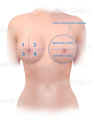 Увеличение груди в Санкт-Петербурге имплантами