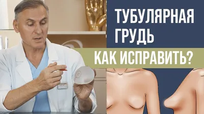 Коррекция тубулярной груди в Киеве - Хирург Бебих