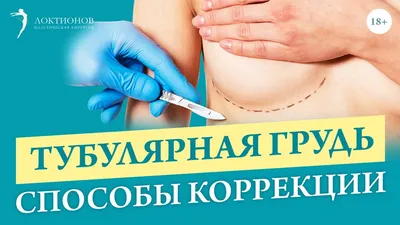 Тубулярная форма груди