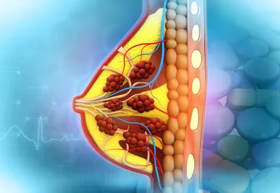 Конусообразная грудь: что делать? | Пластическая хирургия Daily Medical