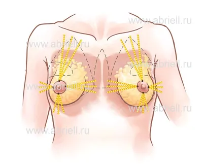 Коррекция тубулярной груди