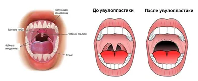 От чего желтеет небо в полости рта