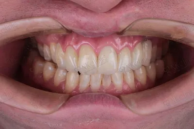 Анатомия для... - АРКОМ - стоматологические материалы | Facebook