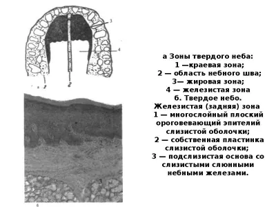 Рак ротоглотки - симптомы, признаки.