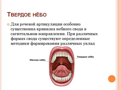 Анатомо-топографические и морфологические особенности слизистой оболочки  различных отделов полости рта - презентация, доклад, проект
