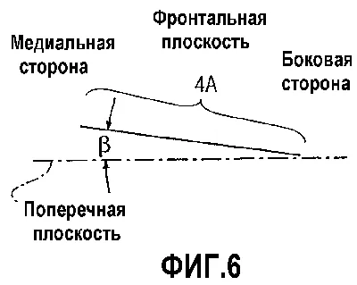 Диабетическая стопа – симптомы, лечение, признаки