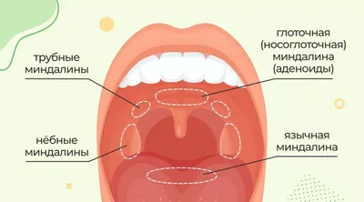 Белые точки на гландах у детей: симптомы и причины появления. Лечение  тонзиллита — Статьи — ОН КЛИНИК Бейби