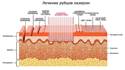 Лазерное удаление шрамов и рубцов на лице в СПб - Цены, отзывы