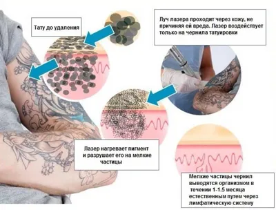 Лазерное удаление татуировок и перманентного макияжа фотографии до и после  в Оренбурге в ЦЭМ \"Вселенная гармонии и красоты\"