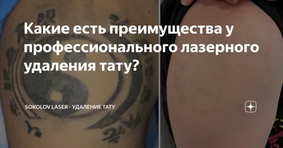 Ответы Mail.ru: Как вывести татуировку в домашних условиях?