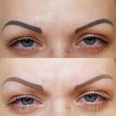 BROW LASH Studio - УДАЛЕНИЕ ТАТУАЖА РЕМУВЕРОМ На фото виден результат после  1й процедуры удаления ремувером 🔹CRC (США)🔹 . Сверху брови до процедуры -  татуажу 8 лет Снизу брови - через 1,5