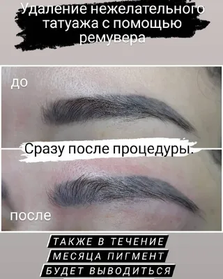 Удаление татуажа ремувером в Сочи: 68 мастеров татуажа с отзывами и ценами  на Яндекс Услугах.