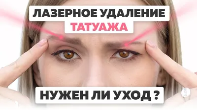 Удаление татуажа бровей пикосекундным лазером PicoSure! - «Мои естественные  брови снова со мной!» | отзывы