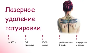 Лазерное удаление тату и татуажа во Львове - клиника Mediostar