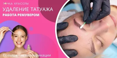 Лазерное удаление татуажа - «Лазерное удаление татуажа глаз » | отзывы