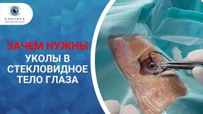 Осложнения после уколов в стекловидное тело глаза (интравитреальные  инъекции)