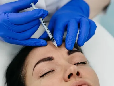 ᐉ Инъекции Диспорта и Ботокса Запорожье ⭐ Косметологическая Клиника  BeautyMED