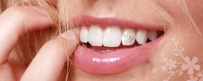 Бриллиантовые зубы: звезды хвастают грилзами из золота и драгоценных камней  » BigPicture.ru