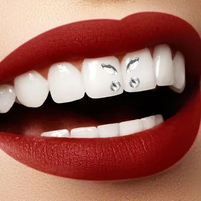 Украшения для зубов: вредно ли? | Юлия Селютина | Дзен
