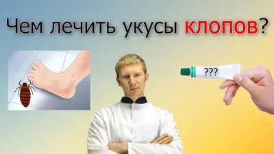 Как избавиться от клопов и их укусов: все средства