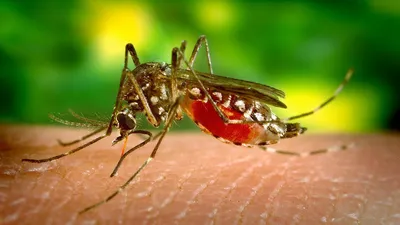 Укус комара: чем можно обработать кожу, чтобы избавиться от зуда