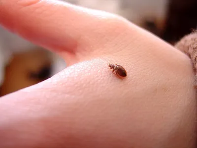 Если у вас есть подозрение на наличие блох в квартире, вот несколько  советов, как распознать укусы этих насекомых и успокоить.. | ВКонтакте