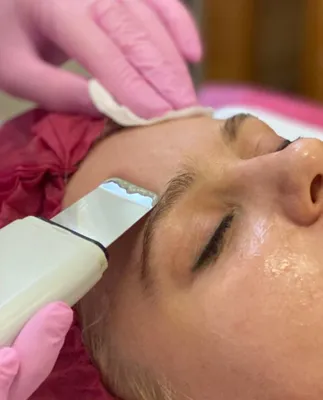 Ультразвуковая, механическая чистка лица в Костроме от чёрных точек, угрей  у косметолога