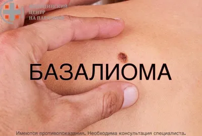 Шишки после уколов: отчего возникают и что с ними делать? | Новости Одессы