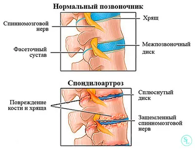 Пояснично-тазовый ритм - KinesioPro