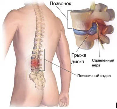 Упражнения на растяжку для достижения поперечного шпагата дома