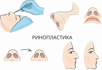 Комплекс упражнений детям для глаз при близорукости