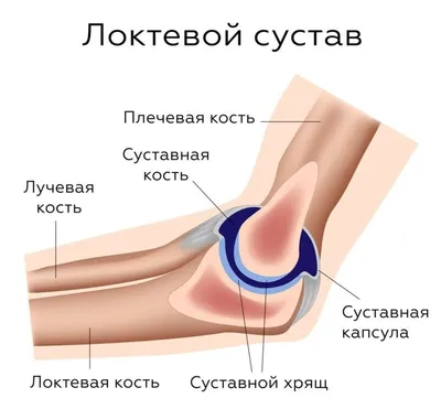 Боль в локтевом суставе: причины и лечение болей в локте при сгибании в  Москве