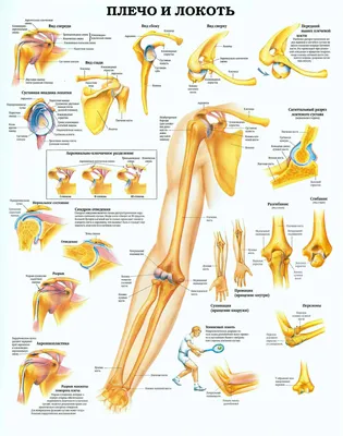 Лечение перелома локтевого отростка, травма локтевого сустава.  http://doctor-savin.ru https:/.. | ВКонтакте