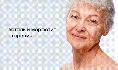 Типы старения кожи