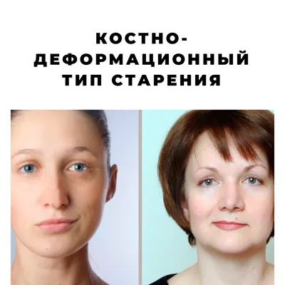 Усталый тип старения лица | Anti-Age Expert