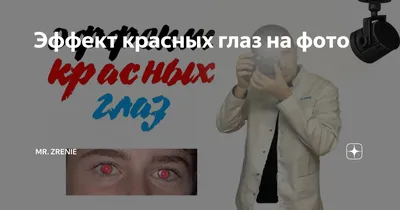 Красный глаз — симптом многих заболеваний, требующих серьезного лечения -  «ФАКТЫ»