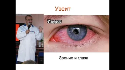 Увеит – общее понятие,... - Avangard Hospital Osh | Facebook