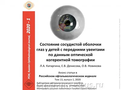 Вопросы классификации и эпидемиологии увеитов – тема научной статьи по  клинической медицине читайте бесплатно текст научно-исследовательской  работы в электронной библиотеке КиберЛенинка