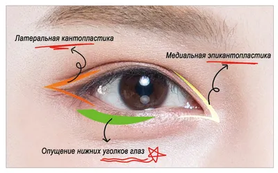 Азиатский разрез глаз — Медицинский центр «Целитель»